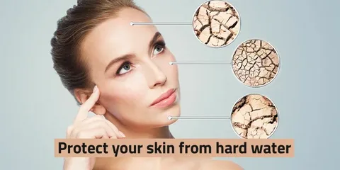 Understanding Dry Skin