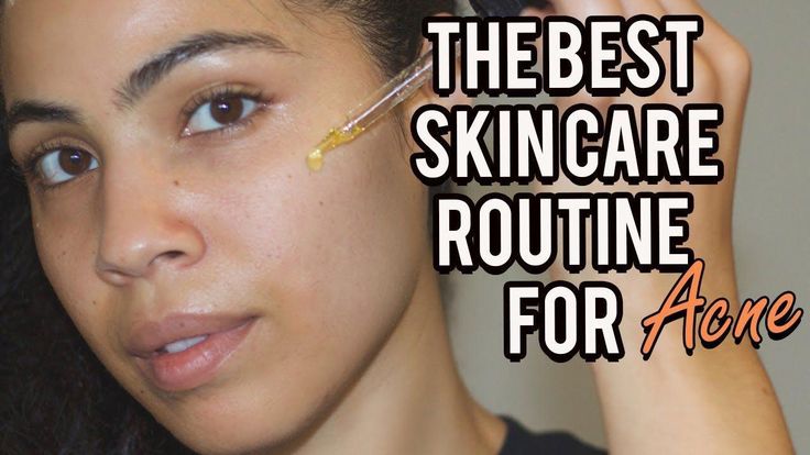 Understanding Your Acne Prone Skin's Needs