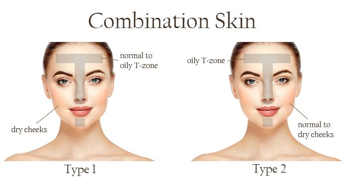 What is Combination Skin