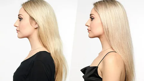 Brassy or yellow tones in blonde hair