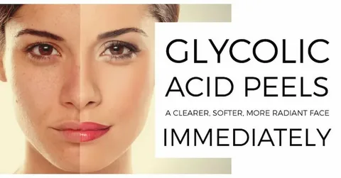 Glycolic Acid Peels