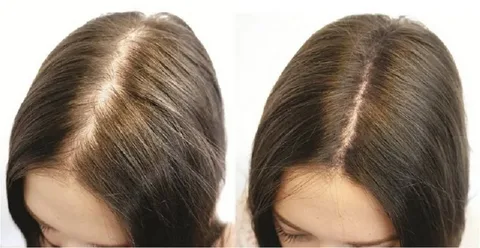 The Science Behind Hair Growth and Loss