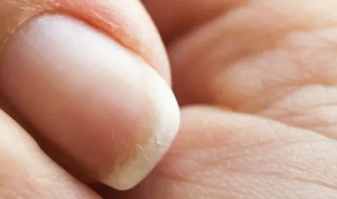 Why Winter Affects Your Nails