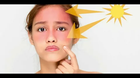 sun is one of the primary causes of skin damage