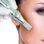 Can You Wear Makeup After Microneedling