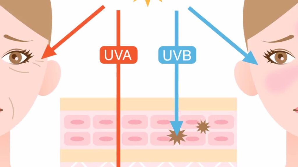 Choosing the Right Sunscreen for Your Skin