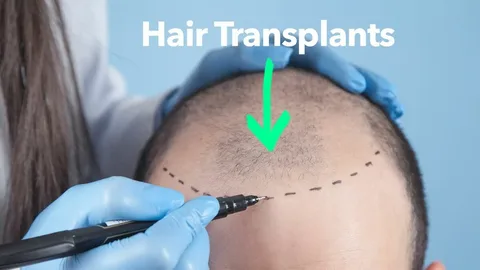 Hair Transplant Surgery