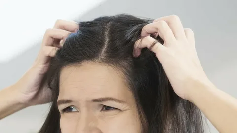 Redness or Tenderness on the Scalp